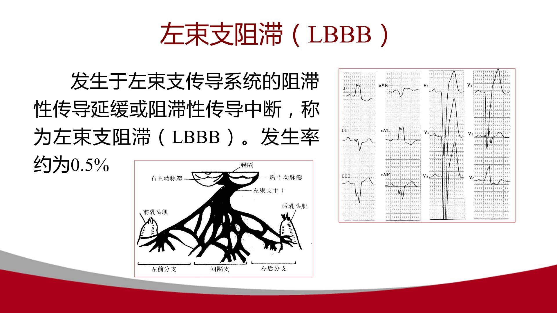 传入侧支性抑制示意图图片