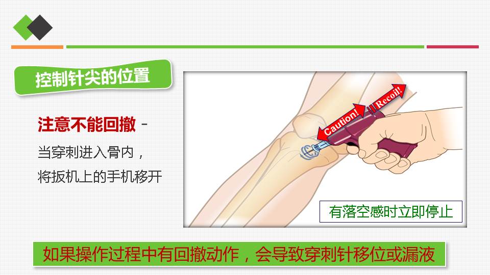 骨穿定位示意图图片