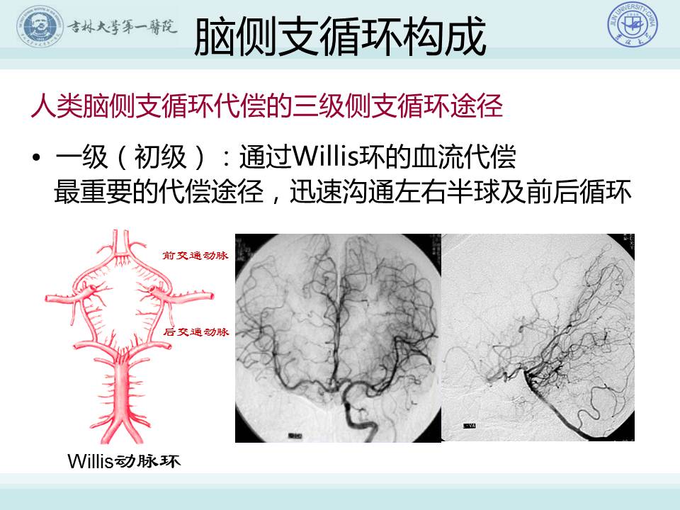 连载 3脑侧支循环建立的重要性与评估技术